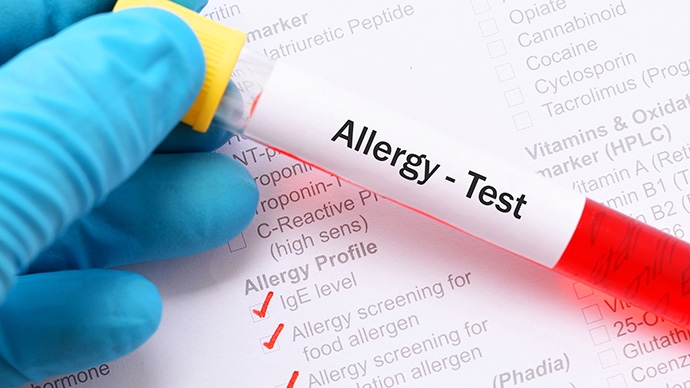 過敏輕則痕癢-重則休克-過敏測試找出食物環境致敏原-改善敏感建議